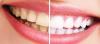 Foto de Dental Max