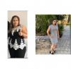 Foto de Cirug�a de obesidad Cuernavaca.
